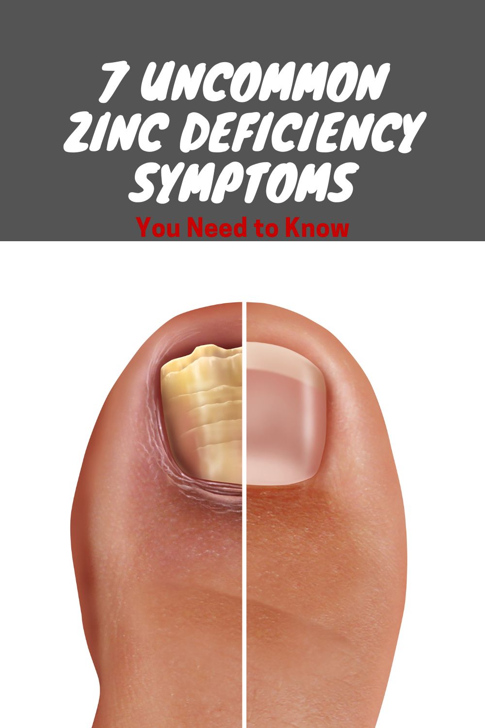 7 Uncommon Zinc Deficiency Symptoms You Need To Know - Life Of A Hero